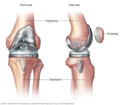 Knee Replacement Surgeon In Pune