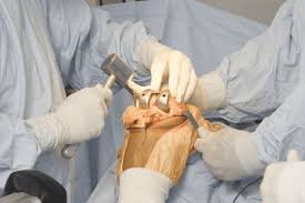 Orthopedic Surgeon In Pune