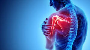 Shoulder Fracture In Pune